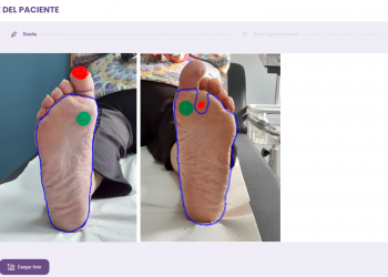 Una ‘app’ cántabra con inteligencia artificial revoluciona el tratamiento del pie diabético en Atención Primaria