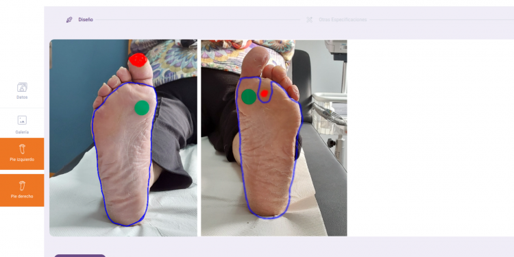 Una ‘app’ cántabra con inteligencia artificial revoluciona el tratamiento del pie diabético en Atención Primaria